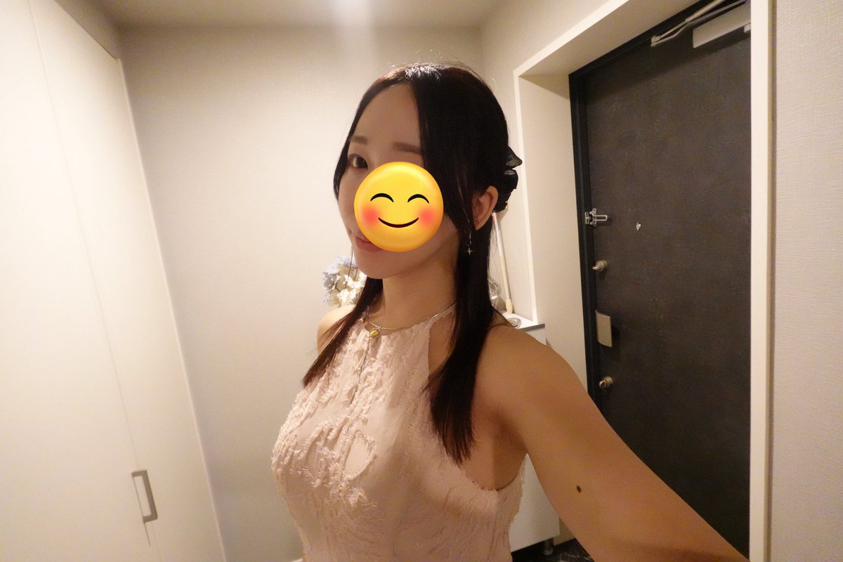 remi_seikei's tweet photo. 術後10ヶ月���11ヶ月、12ヶ月🧸

術後1年経ちました✨
右の耳裏がたまに痛む時があるのですが、それ以外は後遺症などもなくやってよかったです🥹✨
今のところ後戻りとかも感じることはなく、顔が小さくなったので嬉しい☺️

#ビュー美容外科 https://t.co/ghKNyySCdW