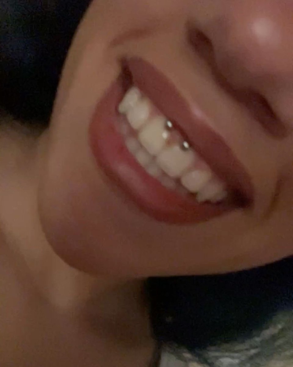 i have an itch but im not allowed to scratch