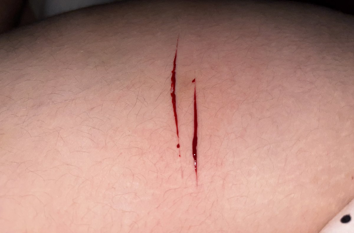 tckito's tweet photo. Two styros from last night https://t.co/i3eFIhsx4C