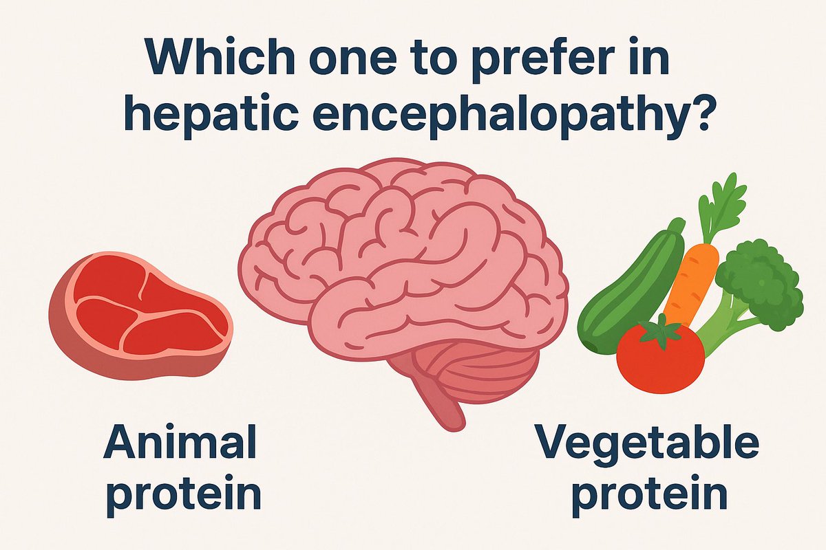 In a patient of hepatic encephalopathy,
⚠️avoid animal proteins rich in AAA (red meat, organ meats, fish)
✅ prefer vegetable &amp; dairy proteins or BCAA formulations

Why ?
Animal proteins are rich in Aromatic Amino Acids which ⬆️ false neurotransmitter production and ammonia load