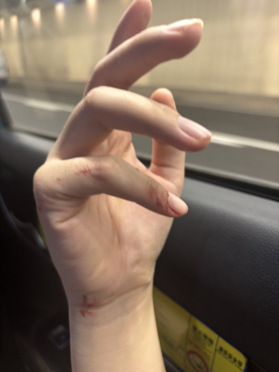 好痛。砸玻璃把自己弄到了