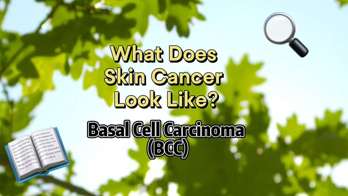 SkinCancerOrg's tweet image. Did you know? Basal cell carcinoma (BCC) is the most common type of skin cancer, but it doesn’t always look the same. These photos give a general idea of what BCC can look like. Stay informed and protect your skin.  SkinCancer.org/bcc  #SkinCancerAwareness #BCC