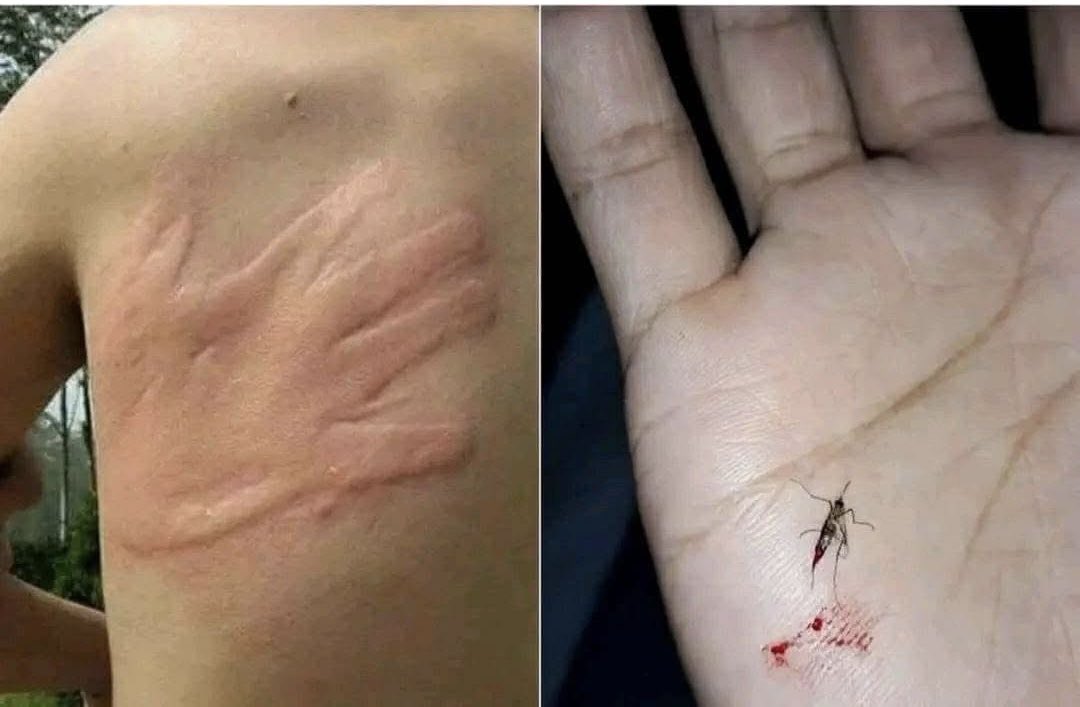 Friend : don’t move 

2 seconds later 😂