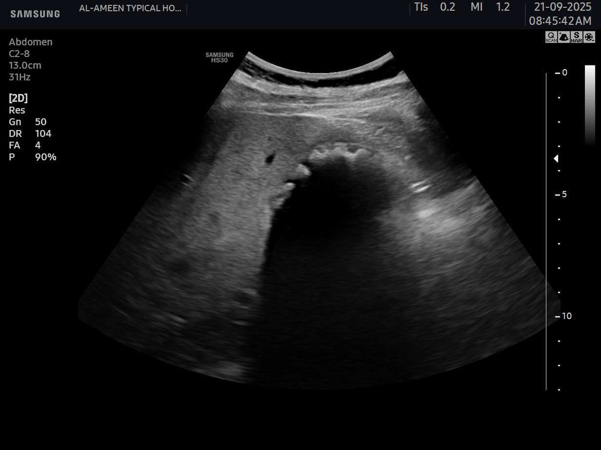 EchoTech_4's tweet image. WES sign &amp;gt;&amp;gt; filled GB with stones.

#EchoTech