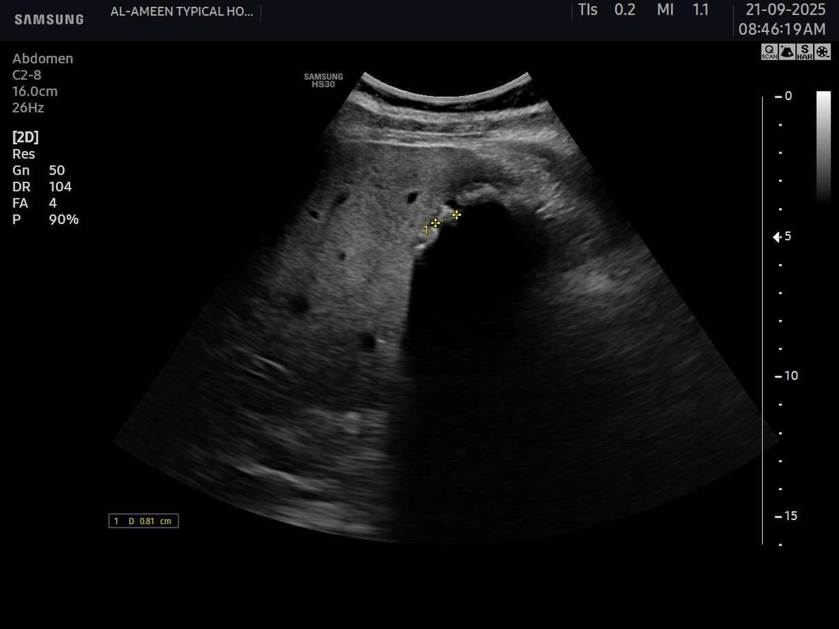 EchoTech_4's tweet image. WES sign &amp;gt;&amp;gt; filled GB with stones.

#EchoTech