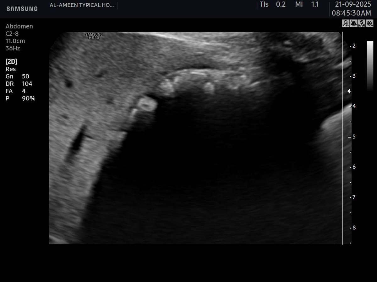 EchoTech_4's tweet image. WES sign &amp;gt;&amp;gt; filled GB with stones.

#EchoTech