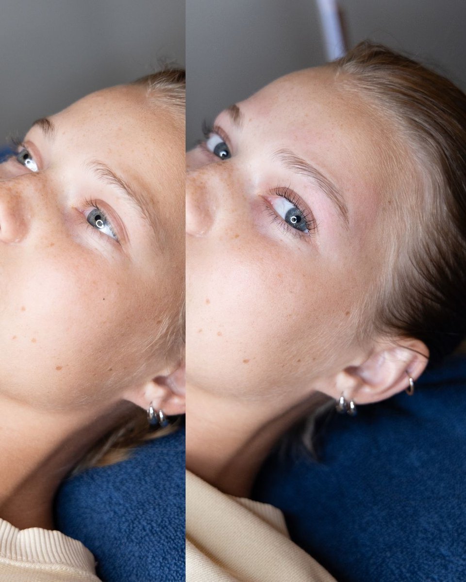 GlowUpStudioUSA's tweet image. Wake up to effortlessly lifted lashes ✨

No mascara, no extensions. A lash lift opens your eyes, adds length and volume, and lasts for up to 6 weeks.

📍 Glow Up Studio Dallas | Lashes, brows &amp;amp; facials all in one place 

#nomascara #lashlift #naturallashes #dallaslashes