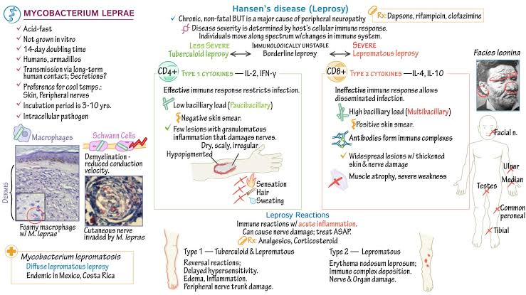 schowardjd's tweet photo. Leprosy (Hansen’s disease)

Likely acquired from armadillo exposure via soil/feces. Patient was treated with rifampin 600 mg monthly, clofazimine 50 mg daily, & dapsone (reduced from 100 mg to 75 mg) daily. At 4 months, she showed marked improvement, though residual edema (L foot), nasal obstruction, toe/nasal anesthesia, & localized alopecia persist.

<Image source: drawittoknowit, https://t.co/aiZELlMMb4>