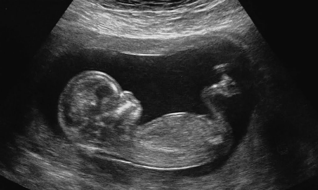 ManSept's tweet image. وانا افتش في صوري لقيت آخر صورة وانا براحه وسعاده ليت الايام تعود 
احد مثلي  !