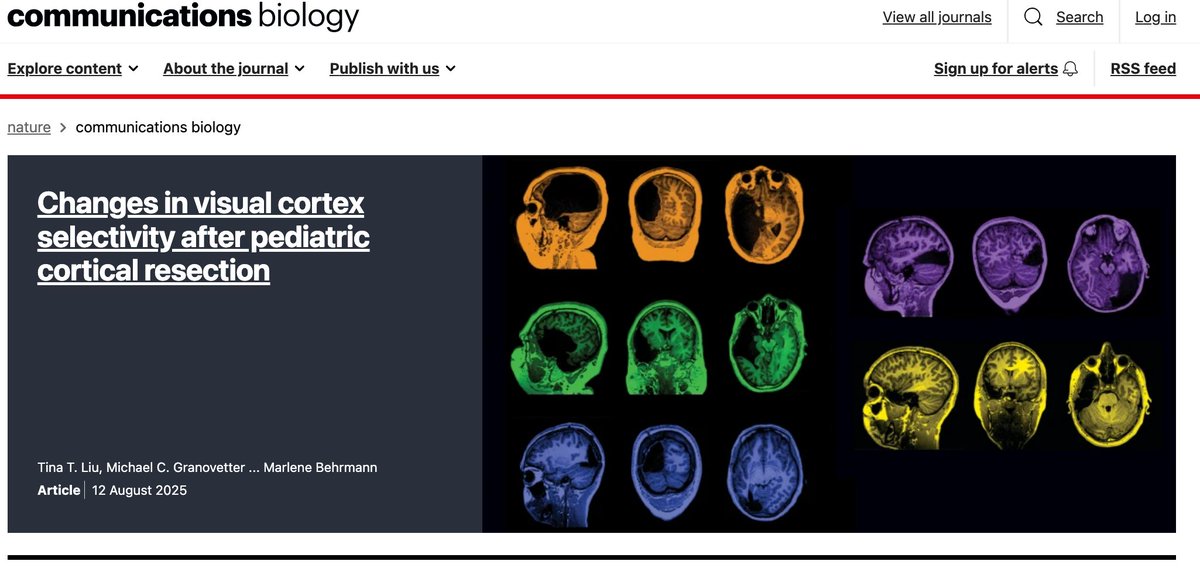 Cover art for our paper featured on this month's homepage of <a href="/CommsBio/">Communications Biology</a>!