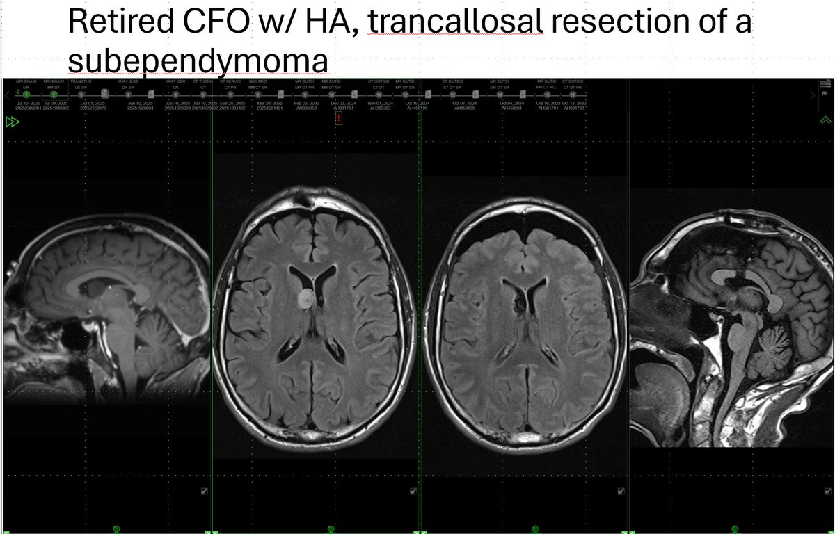 Chu'sYourNeurosurgeon tweet media