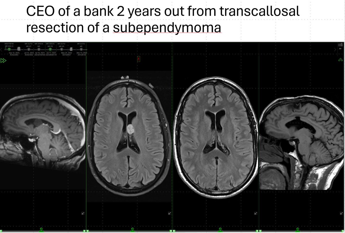 Chu'sYourNeurosurgeon tweet media