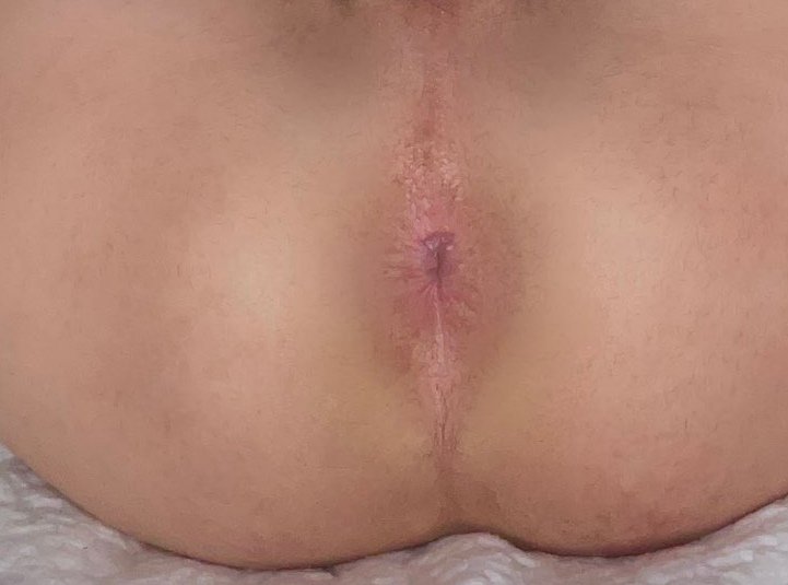 ابي اتناك خرقي مولع مفتوح