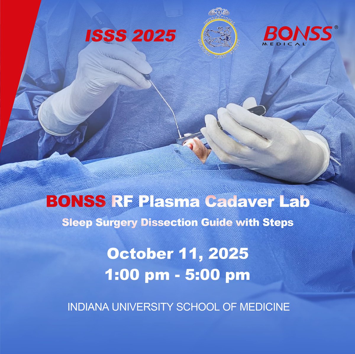 🔬ISSS 2025 Annual Meeting!

Join the ​BONSS RF Plasma Cadaver Lab​ at #ISSS2025 
🛠️ A hands-on, step-by-step dissection guide for sleep surgery.

📅 Oct 11, 2025 | 1:00 - 5:00 PM
📍 Indiana University School of Medicine

#BONSSMedical #Turbinateruduction #UPPP #palatoplasty