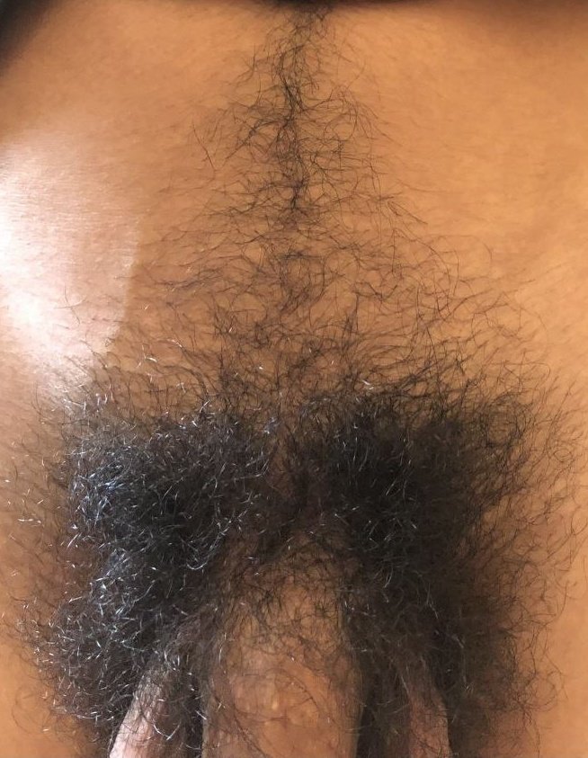 MalePubic_Hair's tweet photo. https://t.co/3hTHa3kCDc