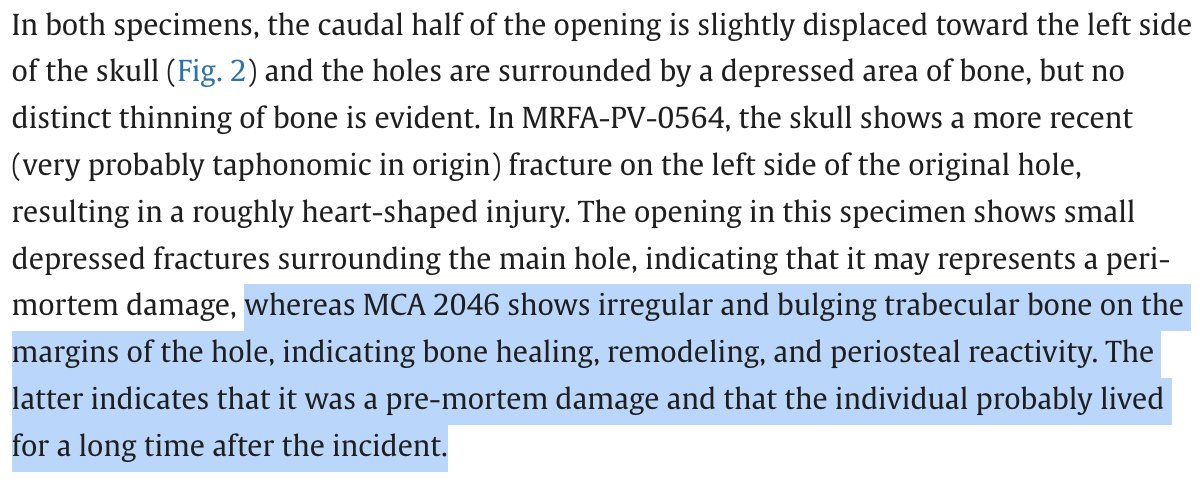 ausar_the's tweet image. The Smilodon populator specimen in A and B survived this injury, as indicated by healed and remodeled bone on the puncture margins. C is a different specimen, and may not have been as lucky. #FossilFriday