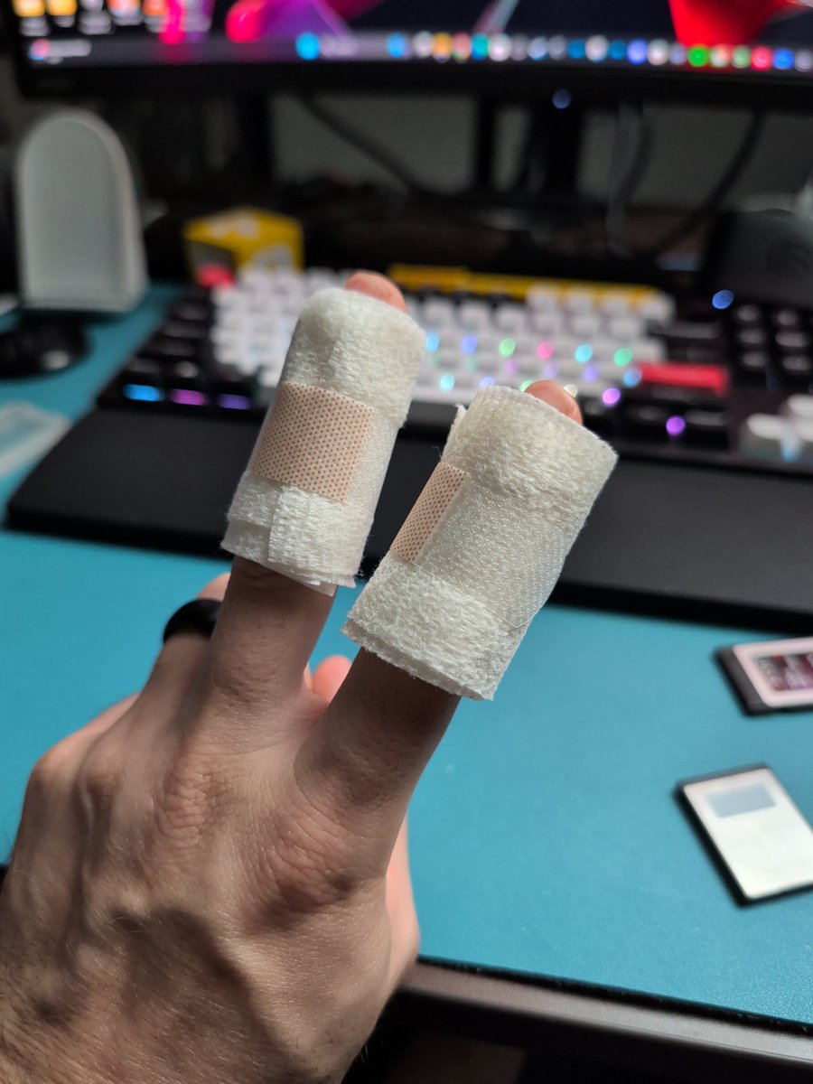 Probably the worst thing about this was that I was getting into a rhythm and schedule for lifting weights. 

I can't lift with a second degree burn on one of my fingers. 

Now I only have cardio, which feels like only half the equation.