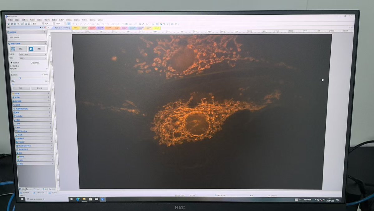 Optolongfilter's tweet image. 🟢 FITC Set (for FITC/GFP/Alexa 488): Very good signal strength. A minor note: users should be mindful of potential bleed-through in complex multi-color experiments.
🔴 Texas Red Set (for Texas Red/mCherry/Alexa 594): Outstanding specificity and brightness.
#Microscopyfilter