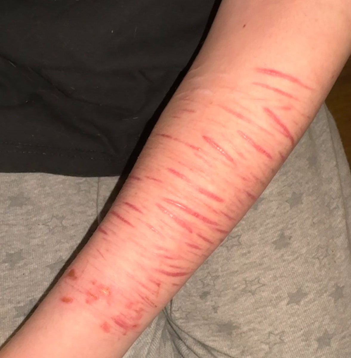 VAL🦄 (worlds worse anorexic) tweet media