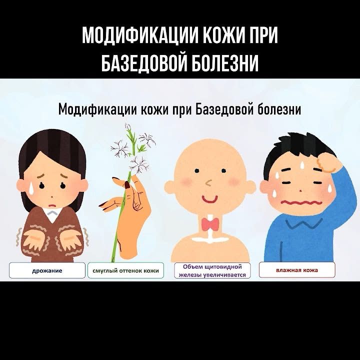 NetBolezniam's tweet image. Модификации кожи при Базедовой болезни #зоб #базедоваболезнь #щитовиднаяжелеза #щитовидка
 ... Продолжение тут: youtube.com/shorts/a4Sy-xY…