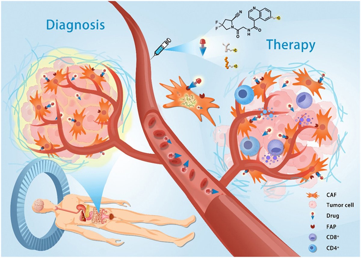 ActaPharmSinB's tweet image. Review🎀#Fibroblast activation #protein #targeting #radiopharmaceuticals: From #drug #design to clinical translation. From Dr. Wang @PekingUnionMedicalCollege; @InstituteofMateriaMedica, @ChineseAcademyofMedicalSciences;
sciencedirect.com/science/articl….