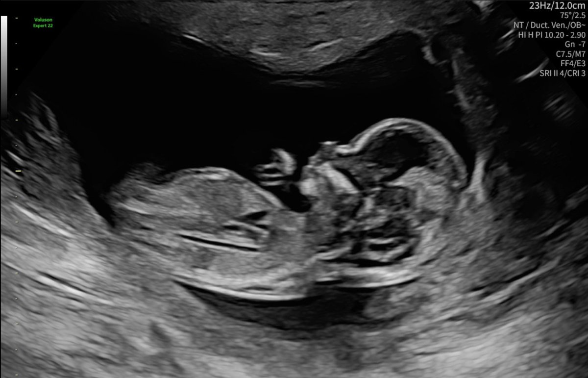 Supreme Leader Wiggum tweet media