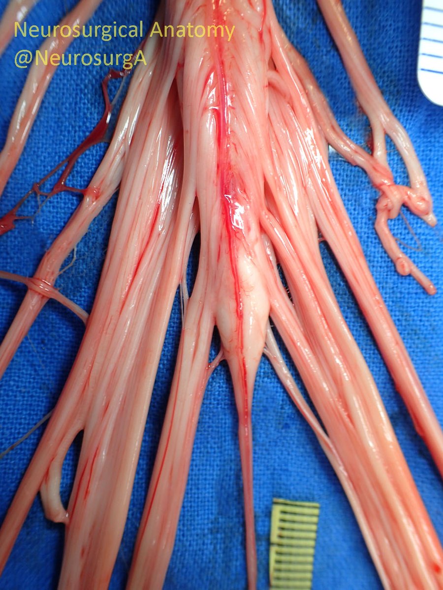 CardiovascularCorner tweet media