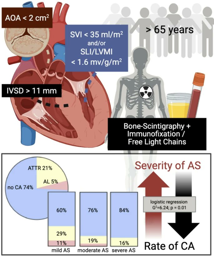 @SN_Oncology (@sn_oncology) on Twitter photo 🚨Recently Published in #CardioOncology
Evaluation of a screening algorithm to detect cardiac amyloidosis in mild to severe aortic valve stenosis🫀
#OpenAccess
Read more➡️doi.org/p7c4 <a href="/vofab/">Fabian Voß</a> <a href="/ICOSociety/">International Cardio-Oncology Society</a> 🚨Recently Published in #CardioOncology
Evaluation of a screening algorithm to detect cardiac amyloidosis in mild to severe aortic valve stenosis🫀
#OpenAccess
Read more➡️doi.org/p7c4 <a href="/vofab/">Fabian Voß</a> <a href="/ICOSociety/">International Cardio-Oncology Society</a>