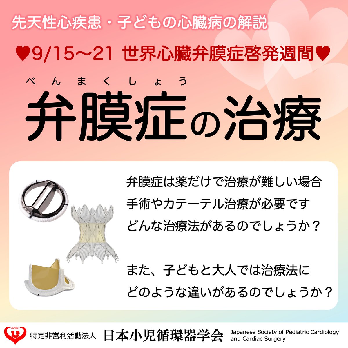JSPCCS's tweet image. 【公式Instagramより】
 
❤️子どもの心臓病の解説 ❤️

＼弁膜症の治療／

2025年9月15日～21日は”心臓弁膜症啓発ウィーク“ 

今回は「弁膜症の治療」について解説します！

弁膜症の治療はどんどん進歩していますが、
子どもと大人では治療の考え方が違います。

どんな治療法があるのか？…