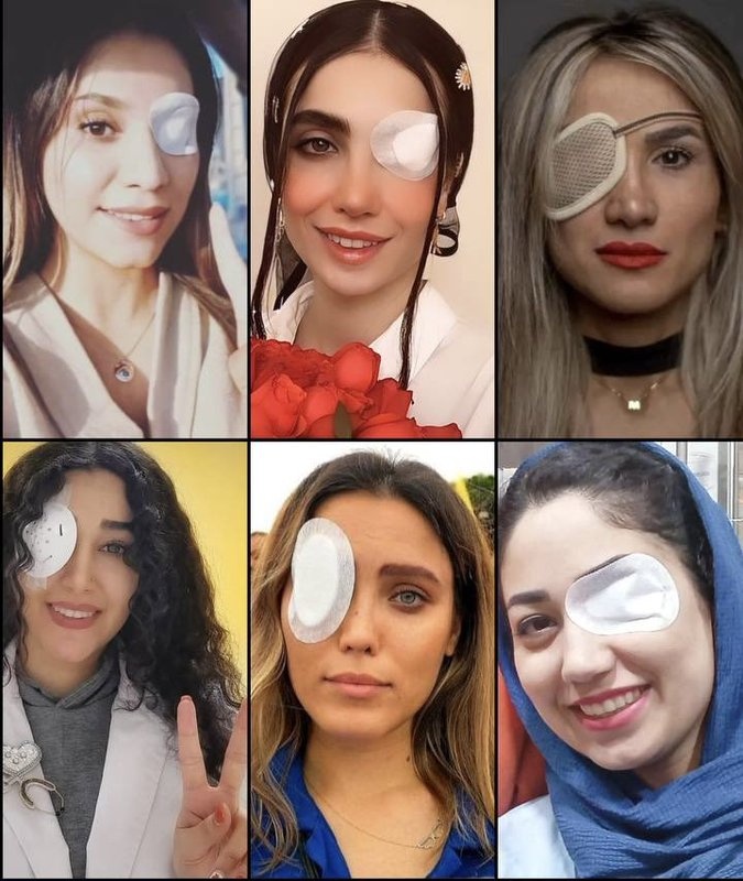 Mosolchi's tweet image. این فرشته ها رو کی کور کرد ؟
بچه شیعه حرومزاده وحشی !!!
#سقوط_دیکتاتور