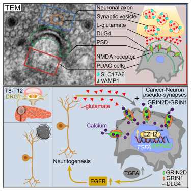 Cancer_Cell's tweet image. Online Now: Sensory neurons drive pancreatic cancer progression through glutamatergic neuron-cancer pseudo-synapses dlvr.it/TNJdXB