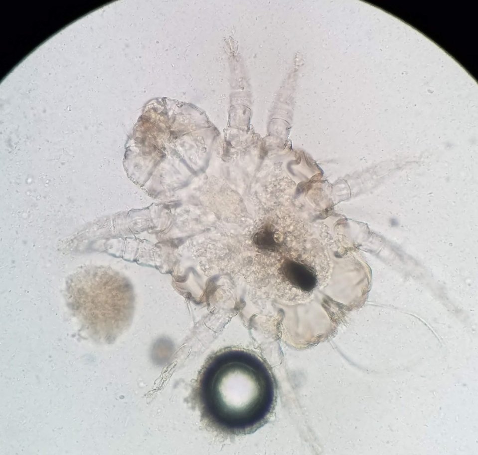 Vet_Parasites's tweet image. Cheyletiella skin mite from a canine fecal. The mouth of Cheyletiella has two large prominent curved papal claws that point inwards. Infestation can be very contagious, especially among young animals or those who are immunosuppresed

#parasitology #parasites #vettech #vetnurse