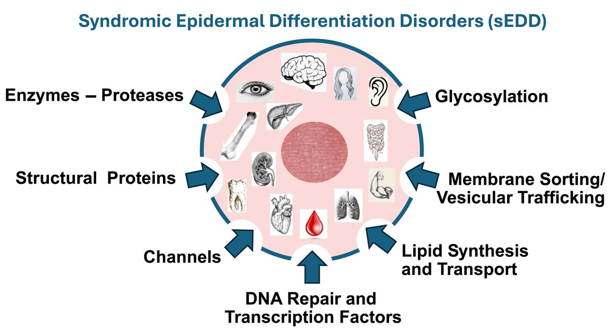 Syndromic epidermal differentiation disorders: a new classification toward pathogenesis-based therapy

The authors present a new gene- and protein product function-based classification for the group of disorders formerly called ichthyosis.

Read more: doi.org/10.1093/bjd/lj…