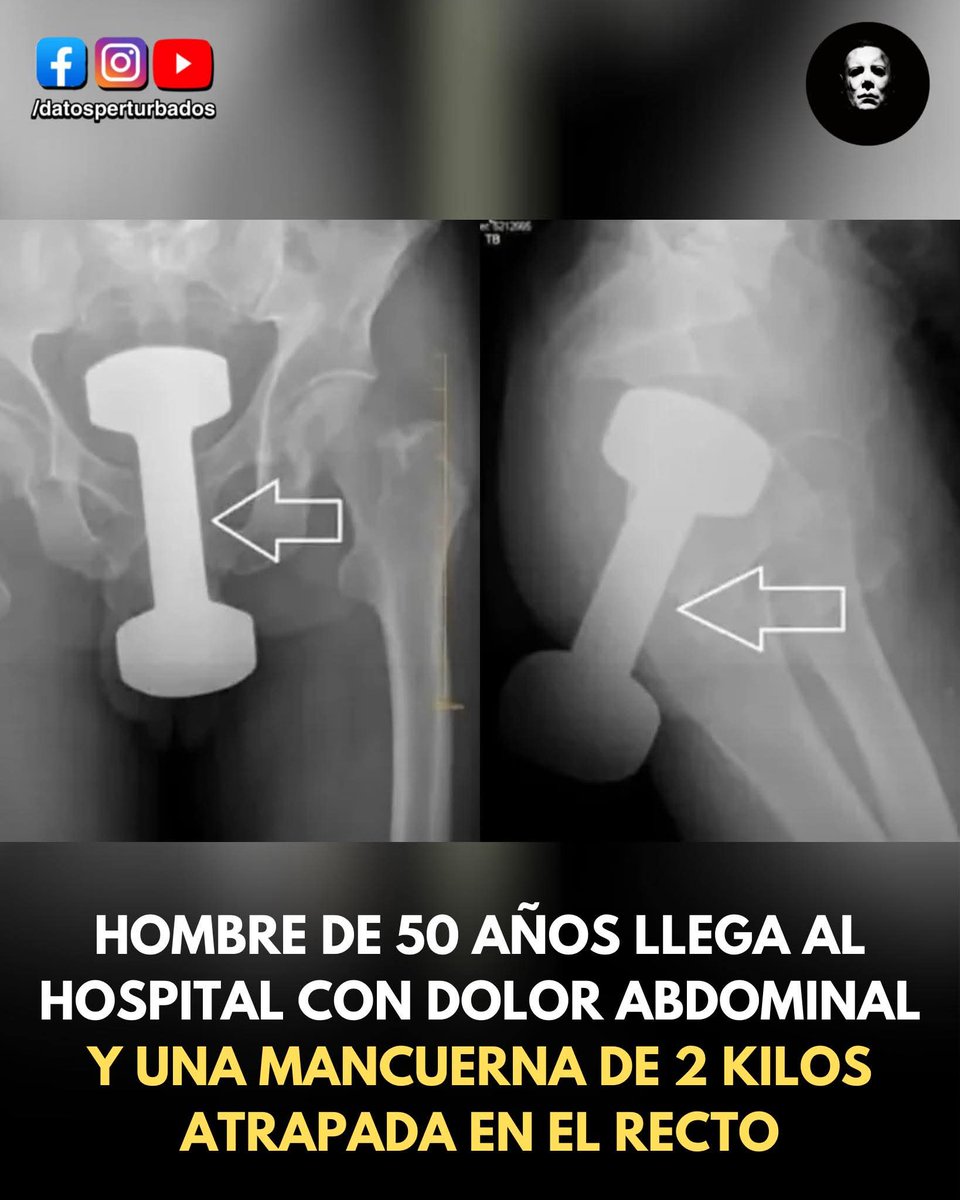 Arranco el gym <a href="/MiguelHutchence/">Miguel Jatchens</a>