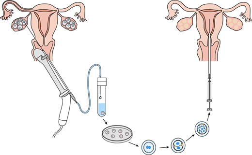In vitro fertilisation (IVF) pioneer Bob Edwards was born 100 years ago today. Learn more about how his legacy has contributed to both assisted reproductive technologies (ART) and developmental biology in this Primer by Martin Johnson

doi.org/10.1242/dev.18…