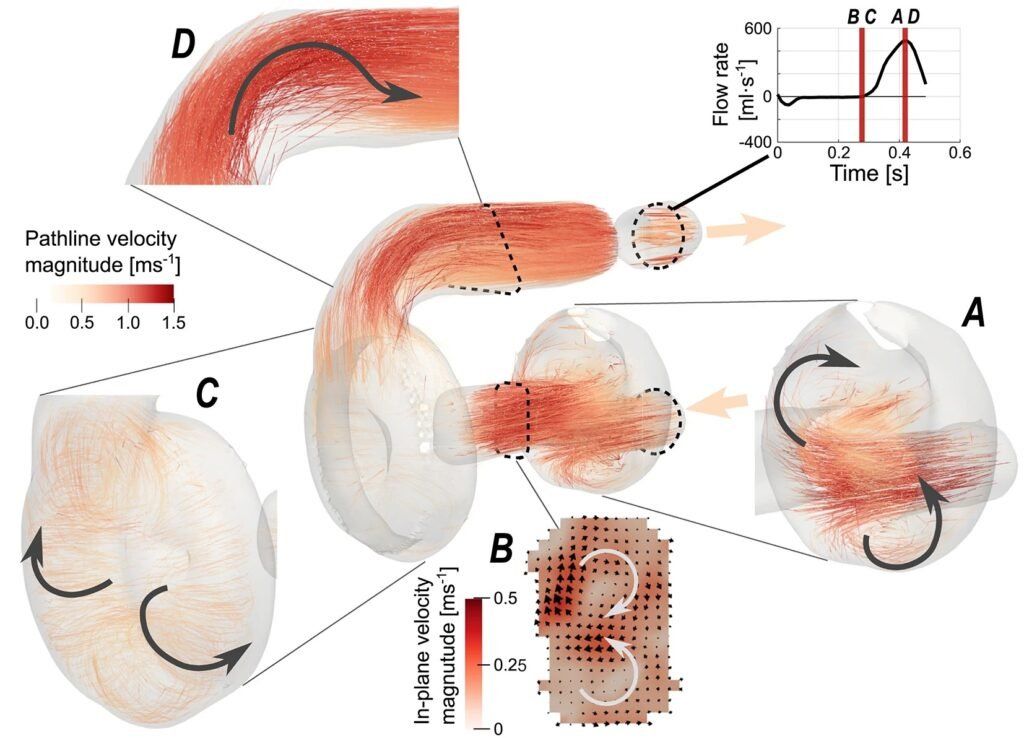 GizmoMD_'s tweet image. Imaging Blood Flow Helps Improve Artificial Heart Design - gizmo.md/2025/09/26/ima… #medtech