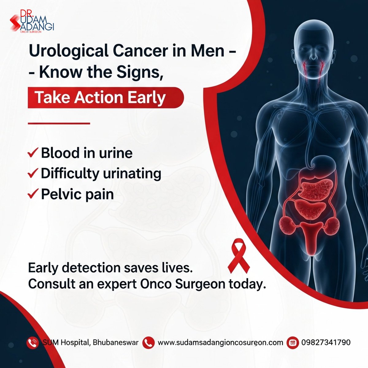 🚹 Urological Cancer in Men – Don’t Ignore the Warning Signs 🚹

Urological cancers such as bladder cancer, kidney cancer, and prostate cancer are becoming increasingly common. One of the earliest symptoms that men often ignore is blood in urine (hematuria). 

#UroOncoSurgeon