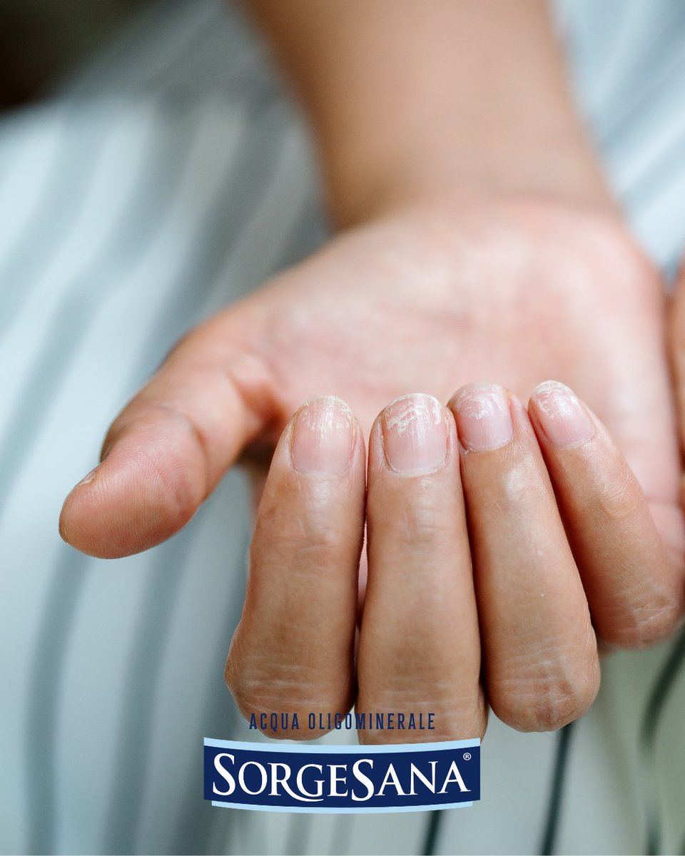 Unghie deboli con il cambio di stagione?

 💅 Con l’autunno le unghie possono diventare fragili e sfaldarsi.

 Bere acqua regolarmente nutre la matrice ungueale dall’interno, rendendole più forti ed elastiche.

sorgesanasalute.it/unghie-deboli-…