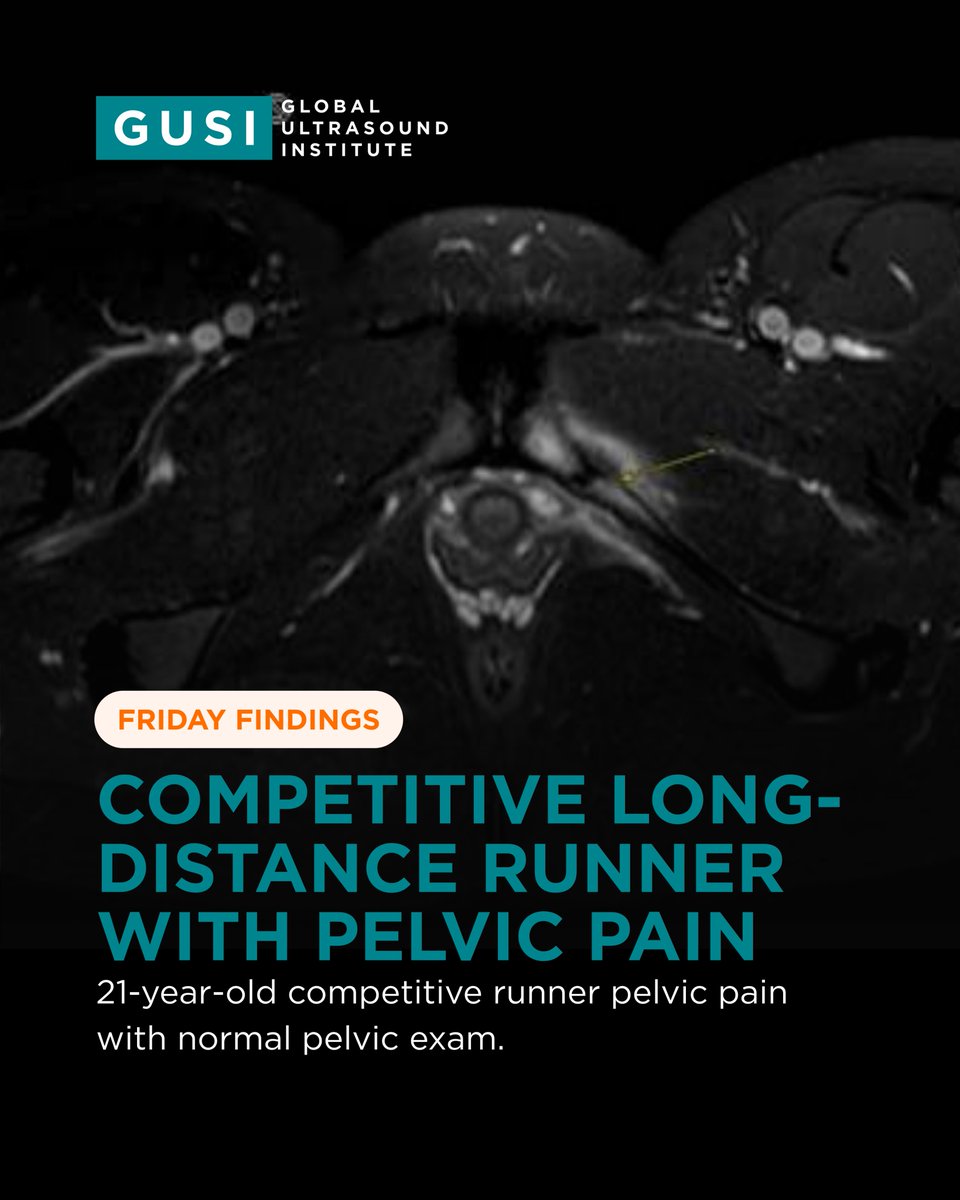 Global Ultrasound Institute tweet media