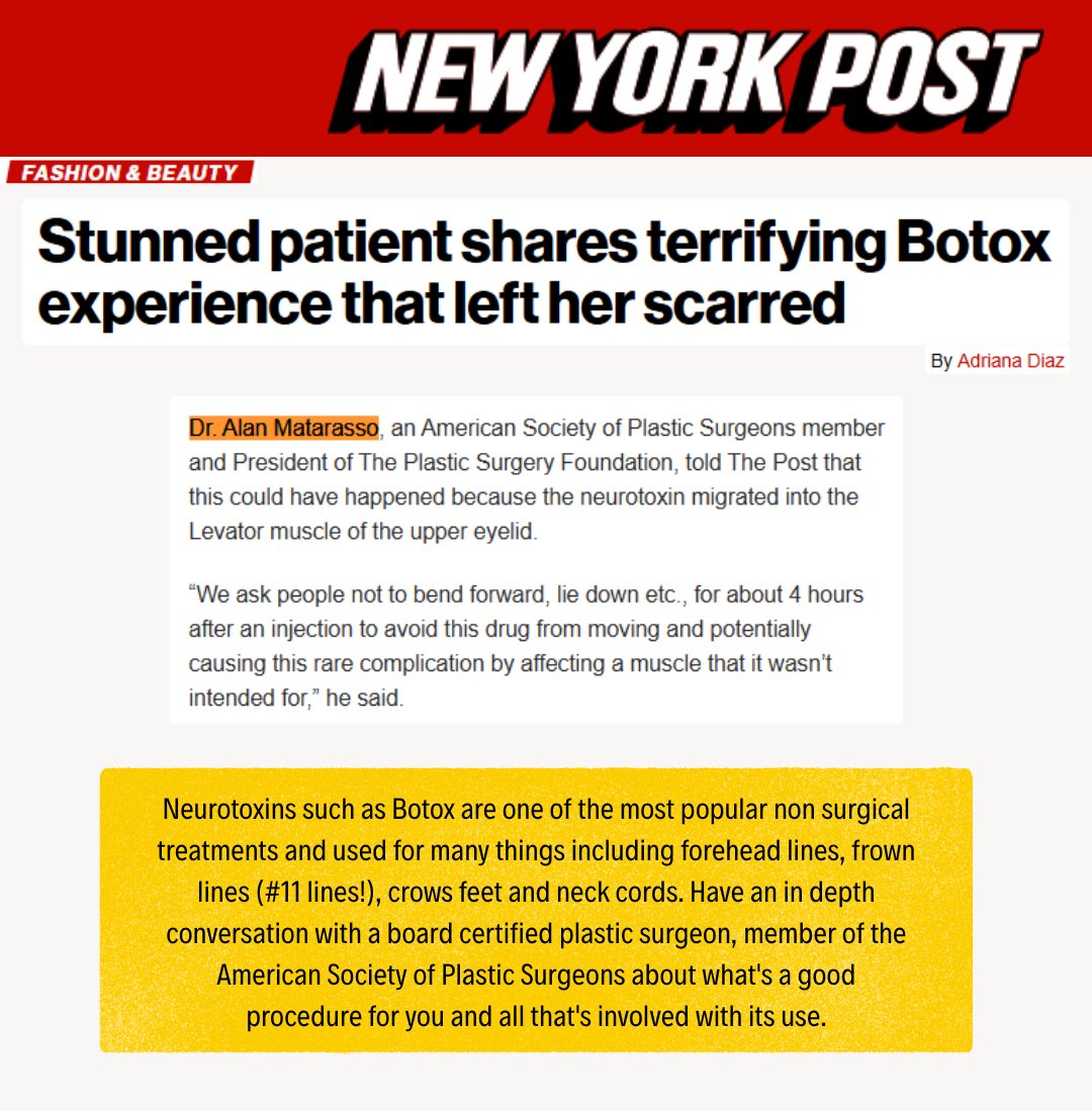DrAlanMatarasso's tweet image. #plasticsurgeonmatarasso #plasticsurgeon #asps #psf #psfpresident #newyorkpost #neurotoxins #botox #foreheadlines #elevenlines #crowsfeet #neckcords #boardcertified