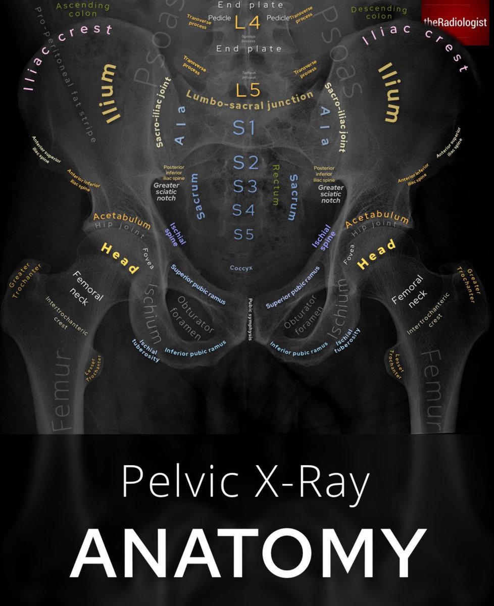 (Pelvic Anatomy)

الصور توضّح عظام الحوض مع أماكن ارتباط العضلات الرئيسة بها