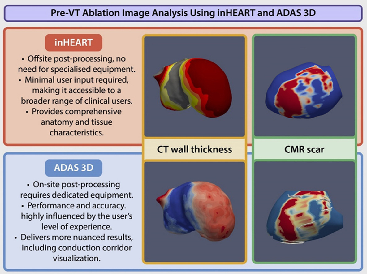 hrs_journal's tweet image. Ventricular Tachycardia Substrate Mapping with Cardiac Computed Tomography and Cardiac Magnetic Resonance Imaging: Head-to-head Comparison of Two Clinically Available Post-processing Platforms #OpenAccess 

heartrhythmjournal.com/article/S1547-…
