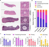 Shikanov lab <a href="/UMBME/">U-M BME</a> is excited to share "Dynamics of YAP localization and transcript activity in human oocytes and granulosa cells across early‑stage folliculogenesis" rdcu.be/eIm3m
and funded by <a href="/czi/">Chan Zuckerberg Initiative</a> 
and @NICHD_NIH #ovary #gofollicles #oncofertility