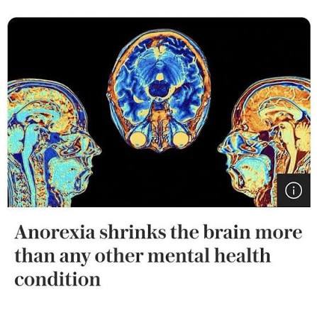 agaredtwt's tweet image. why are we using ai cmon now