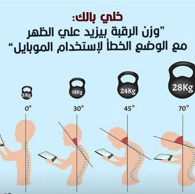 PT_AFR's tweet photo. انحناء الرأس على الجوال يزيد الحمل على الرقبة لـ ٢٧ كجم تقريبًا! 😰 خلك معتدل وارفع جهازك لمستوى العين. #آلام_الرقبة

#علاج_طبيعي 
#تبوك https://t.co/VLQ6FLioYY
