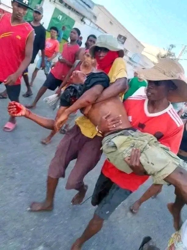 fetiarison_'s tweet photo. ‼️🆘Madagascar is crying for help. Citizens are shot, silenced, abandoned. Families can’t sleep at night. 

#SOSMadagascar https://t.co/j7kQdEmp6V