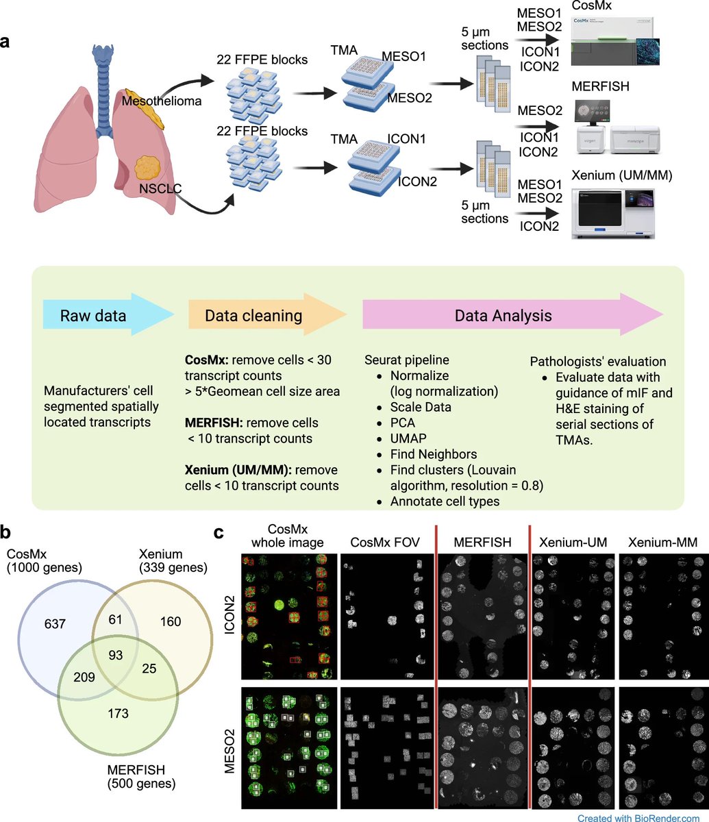 CosMX, MERFISH, Xenium… so many choices, so little time and money! 
Nice study from <a href="/MDAndersonNews/">MD Anderson Cancer Center</a> comparing these single cell resolution platforms in archival materials.
nature.com/articles/s4146…
TL;DR there is no one perfect answer. Many factors including block age matter.