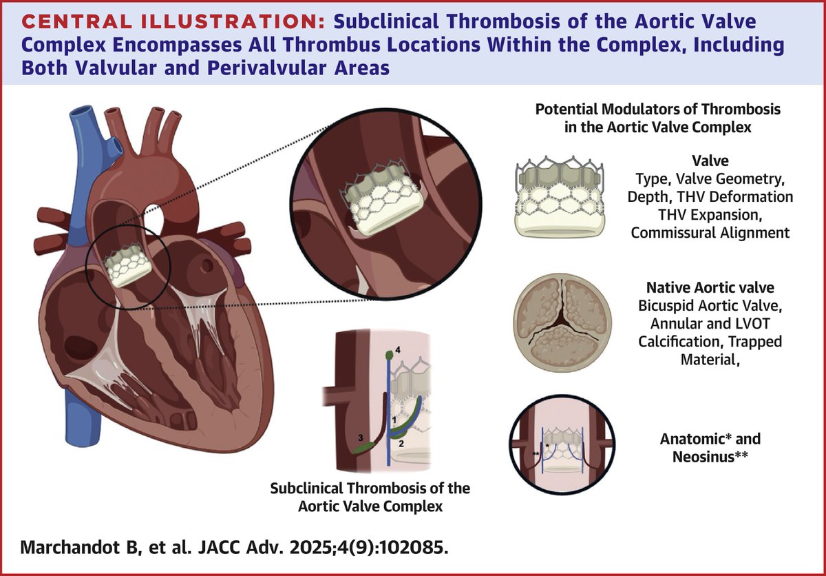 New #JACCAdvances review offers a comprehensive analysis integrating device geometry, sinus flow dynamics, and native tissue activity to inform personalized, time-limited anticoagulation strategies in high-risk patients jacc.org/doi/10.1016/j.… #TAVR