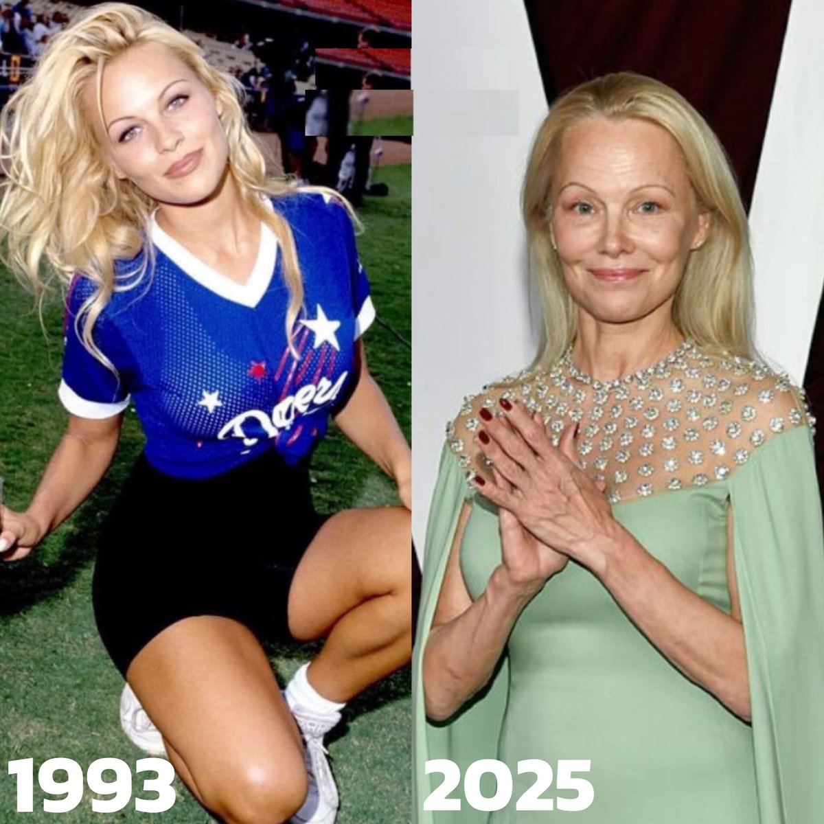 modernhistory's tweet image. Pamela Anderson 1993/2025