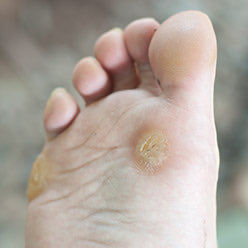 comment j’imagine les pieds de notre premier ministre à chaque fois que j’entends son nom :